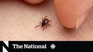 Lyme disease vaccine for humans being developed