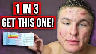 How Many People Get The MOST Common Accutane Side Effects?