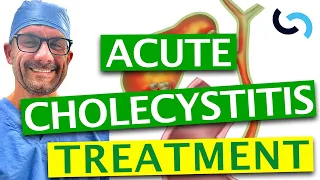 How to Treat Acute Cholecystitis - The Inflamed Gallbladder