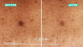 Bright Reveal Niacinamide Dark Spot Serum | L'Oréal Paris® Australia & NZ