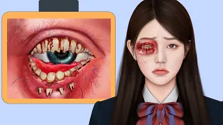 ASMR Remove "Teratoma" Teeth & Worm Infected Dirty Eyes | Deep Cleaning Animation