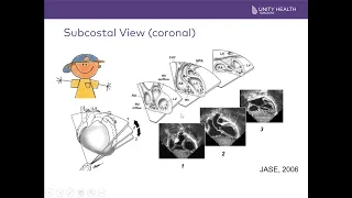 Introduction to Paediatric / Pediatric Echocardiograms and Common Critical Congenital Heart Defects