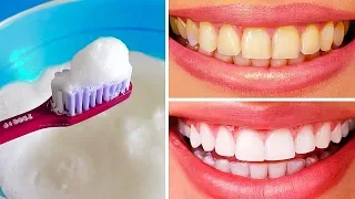 عشرُ طرقٍ طبيعيةٍ لتبييض الأسنانِ الصفراءِ في المنزل
