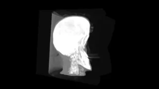 Volume Deformation using Chain Mail algorithm