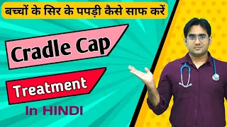 Cradle Cap Treatment in Hindi| बेबी के सिर से पपड़ी कैसे हटाएं | Dr Md Noor Alam Khan