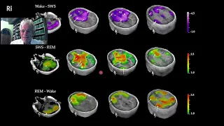 Mark Solms   What Do Our Brains Do When We're Dreaming  3 of 4