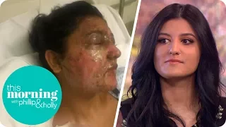 The Aspiring Model Scarred for Life in an Unprovoked Acid Attack | This Morning