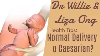 For pregnant women: How to know if you are Normal delivery or Caesarian by Doc Catherine Howard