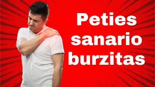 Peties sanario burzitas. Kas tai, kaip gydyti? Kineziterapijos pratimai