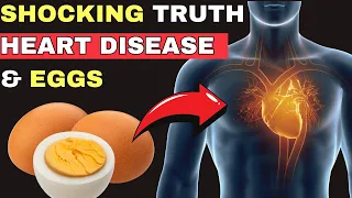 SHOCKING Truth About Eggs & Heart Disease in MEN