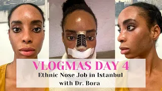 NOSE JOB IN ISTANBUL WITH DR. BORA: VLOGMAS DAY 4 | CONSULTATION DAY, CLINIC REVIEW & HOTEL MOVE