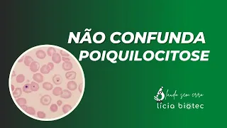 O que é Poiquilocitose - biomedicina - Análises Clínicas