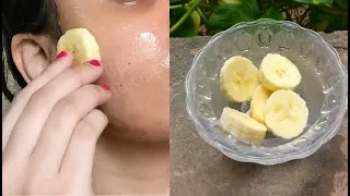 i rub Banana on my Skin Every Night & it removed my Wrinkles, Dark Spots & Pimples