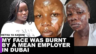 'A mean employer in Dubai burnt my face, refused to take me to hospital & took away my passport-Mary