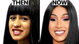 Cardi B NEW FACE | Plastic Surgery Analysis