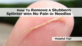 5 Home Remedies to Remove a Splinter Safely Without Pain | By Top 5.