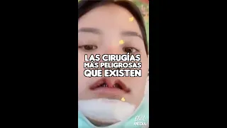 LAS CIRUGÍAS MÁS PELIGROSAS QUE EXISTEN EN EL MUNDO #Shorts