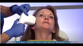 Dr. Elizabeth Tanzi Tells ABC7 About Sofwave™