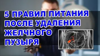 Как питаться после удаления желчного пузыря | 5 ПРАВИЛ ПИТАНИЯ ПОСЛЕ УДАЛЕНИЯ ЖЕЛЧНОГО ПУЗЫРЯ