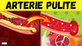 ♥️ Questi 10 ALIMENTI puliscono le ARTERIE e SALVANO il tuo CUORE 🫀