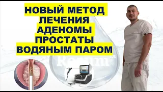 НОВЫЙ МЕТОД ЛЕЧЕНИЯ АДЕНОМЫ ПРОСТАТЫ ВОДЯНЫМ ПАРОМ