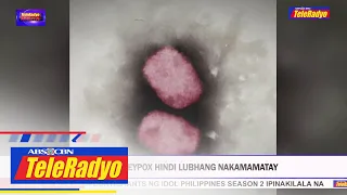 Expert: Monkeypox hindi lubhang nakamamatay | TeleRadyo Balita (8 Aug 2022)