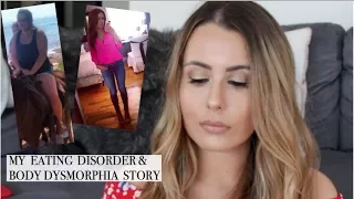 MY EATING DISORDER & BODY DYSMORPHIA STORY