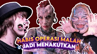 Malah Jadi Aneh!!! 5 Operasi Plastik Terekstrim di Dunia