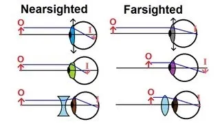 Physics - Optics: Vision Correction (1 of 5) Introduction