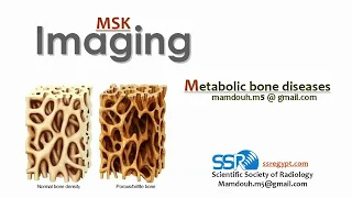 Metabolic Bone diseases .. Prof.mamdouh Mahfouz (2019 edition)