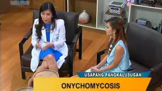 Good Morning Kuya: Onychomycosis (Fungal Nail Infection)