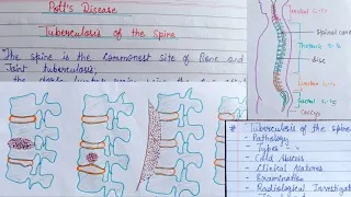 Pott's Disease (part-1)/ Tuberculosis of the spine