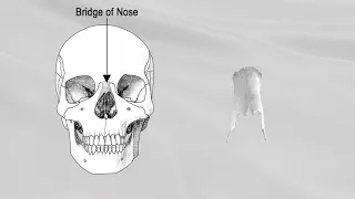 NASAL BONE