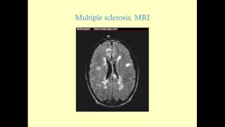 Multiple Sclerosis - CRASH! Medical Review Series
