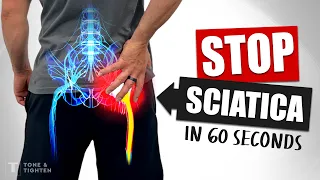 Eliminate Sciatic Nerve Pain FAST - 60-Second Sciatica Relief!