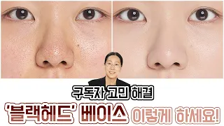 [ENG] 구독자 고민 해결! 당신의 베이스가 무너지고 뭉치는 이유. (피지 꽉 박힌 코 & 큰 모공 & 홍조 피부)