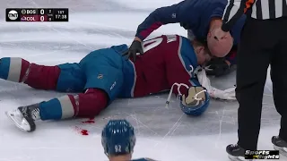 Nathan MacKinnon bloodied after a hit by Taylor Hall