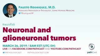 Neuronal and glioneuronal tumors - Dr. Rodriguez (Hopkins) #NEUROPATH