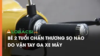 Bé hai tuổi ngã nguy kịch sau khi vặn tay ga xe máy