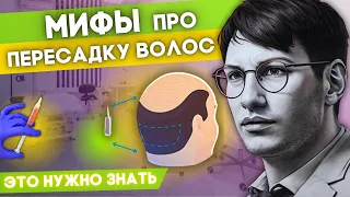 Что нужно знать перед тем как делать ПЕРЕСАДКУ ВОЛОС?