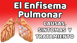 ENFISEMA, Causas, signos y síntomas, diagnóstico y tratamiento