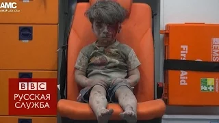 Видео с раненым мальчиком из Алеппо потрясло мир