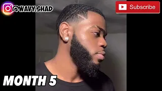 Minoxidil Beard Journey 5 Month Transformation INSANE RESULTS   😱