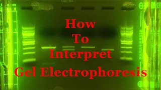 Interpreting Gel Epectrophoresis