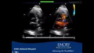 Emory Cardiology Grand Rounds 09-22-2014