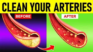 Clean Your Arteries With These Nutritious Foods