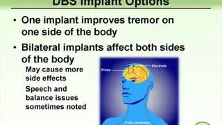 IETF Essential Tremor Surgical Options.wmv