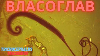 Власоглав Человеческий (Trichocephalus trichiurus) Морфология, Жизненный Цикл, Симптомы, Диагностика