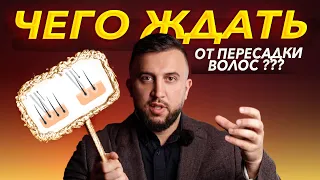 ЧЕГО ЖДАТЬ ОТ ПЕРЕСАДКИ ВОЛОС?