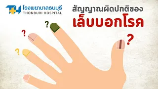 สัญญาณผิดปกติของเล็บบอกโรค : โรงพยาบาลธนบุรี